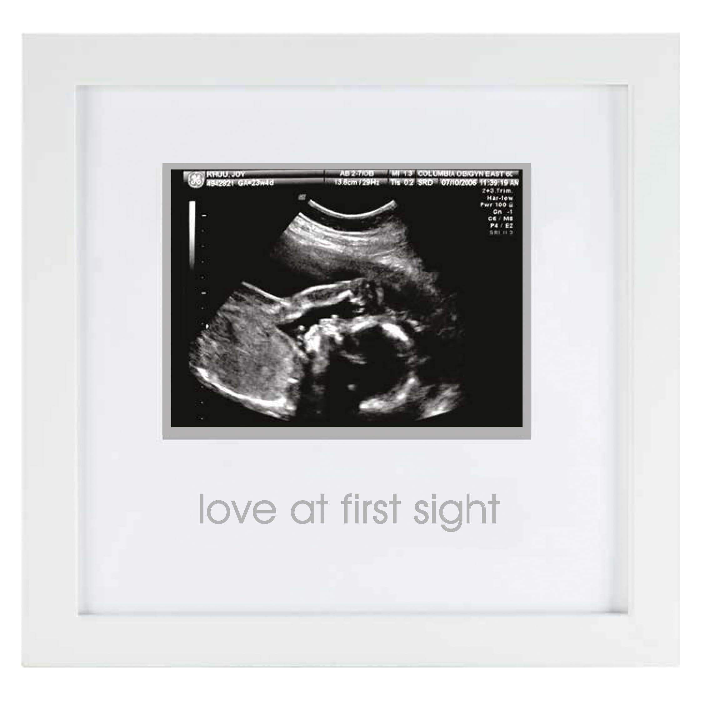 Moldura de Ultrassom Pearhead Love at First Sight